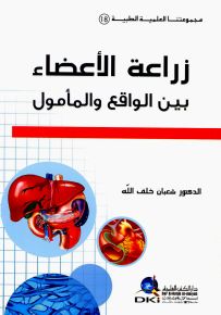 زراعة الأعضاء بين الواقع والمأمول